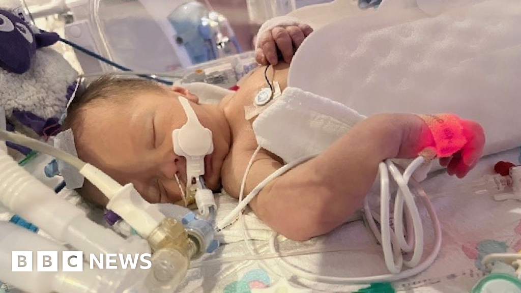 186f8d50 fb98 11f0 a47f d352a7d9988a.png