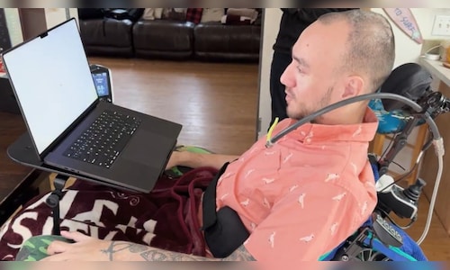 Nerualink brain implant 2026 01 bf34f2a34d1ec39e81b03ecd7f7fbc8c.jpg